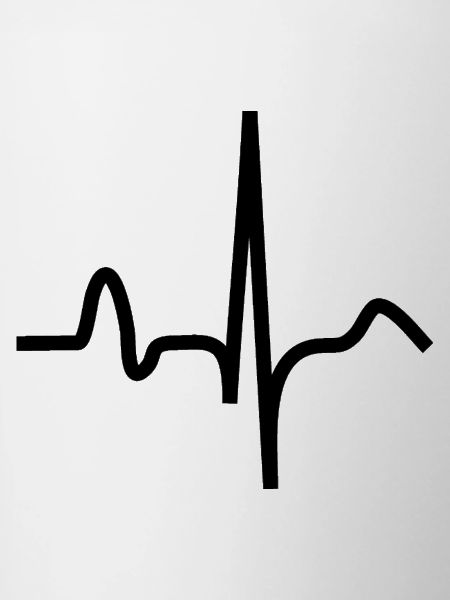 EKG