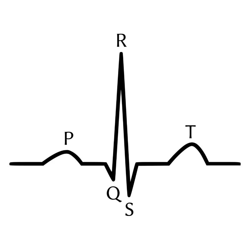 EKG: Sinusrhythmus - schwarz