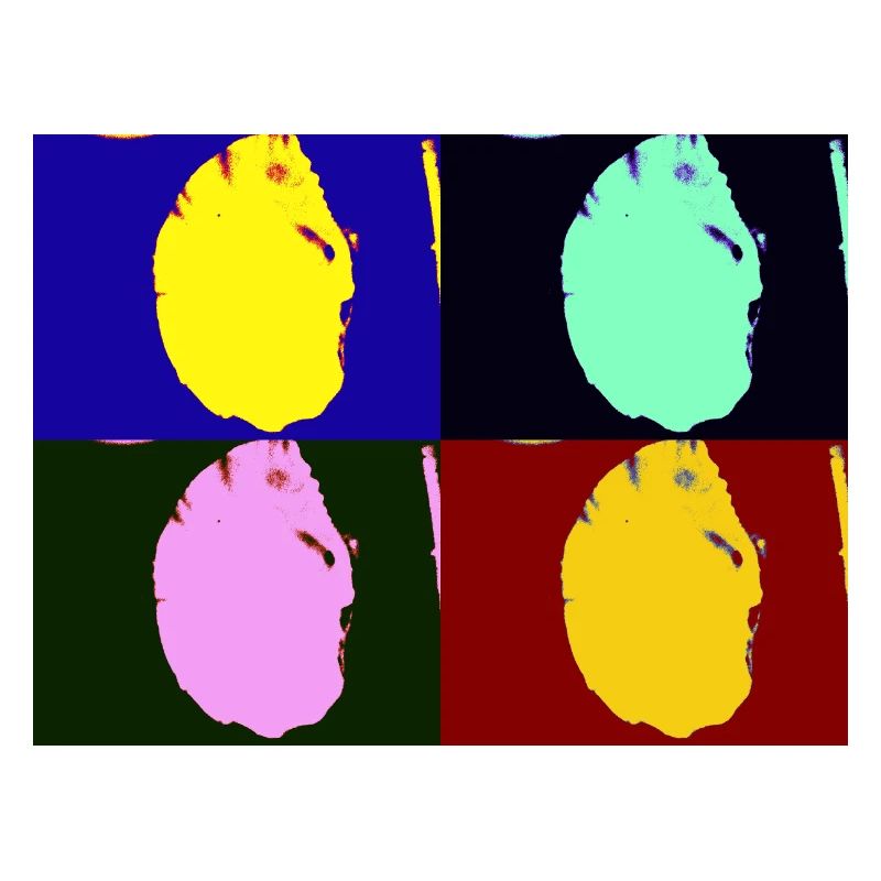 Shell head
