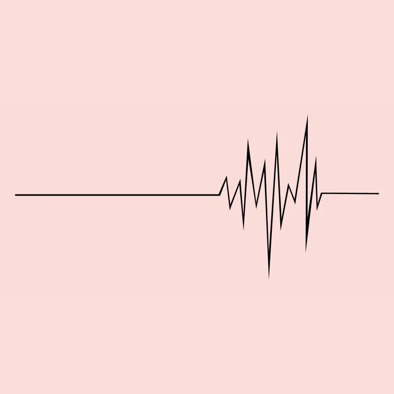 ECG (md)
