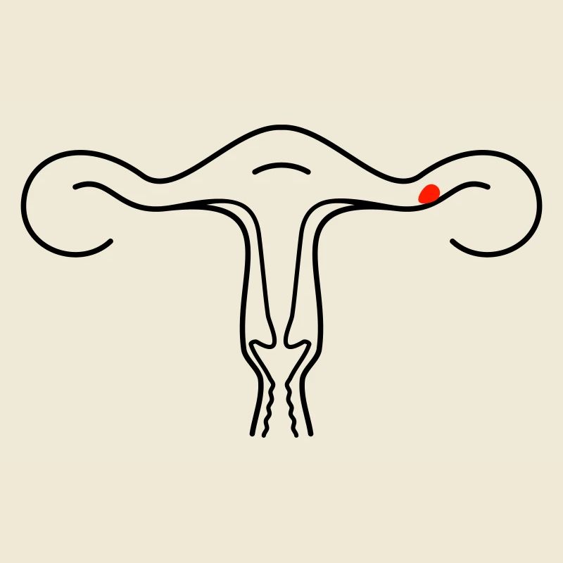 Schematic uterus (2c)