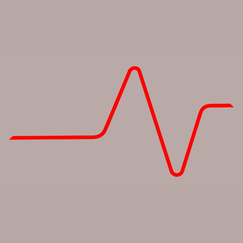 EKG