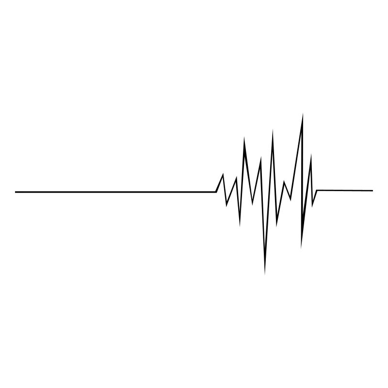 ECG (md)