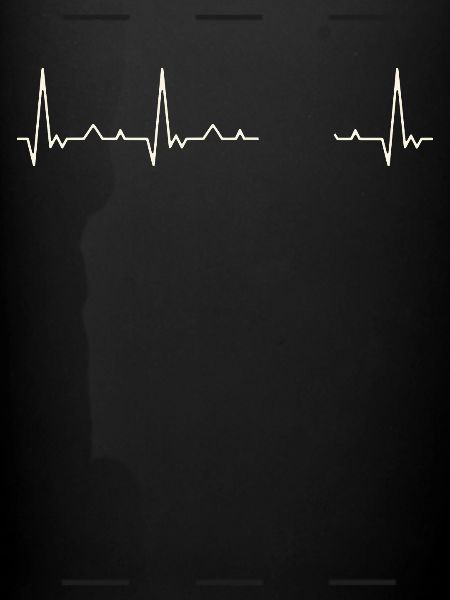 Bil Klassisk 1920'erne. Kærlighed. EKG. Puls. Slå.
