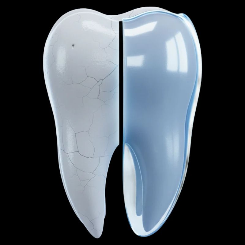 gesunder-kaputter-zahn-vorher-nachher-3d