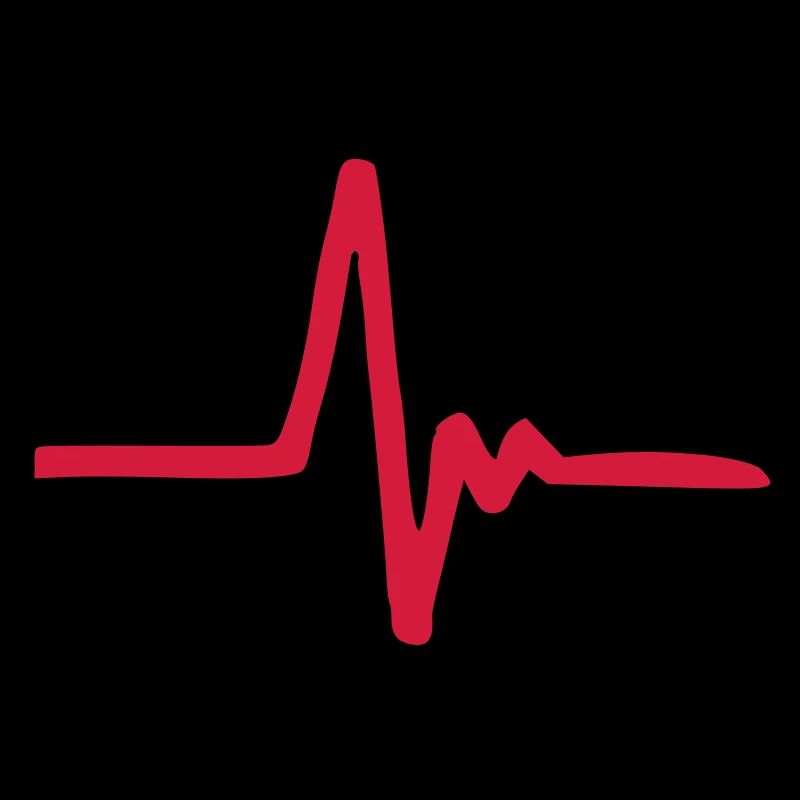 EKG