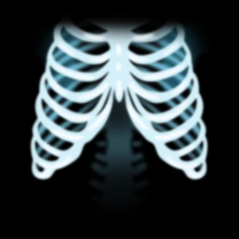 X-ray ribs