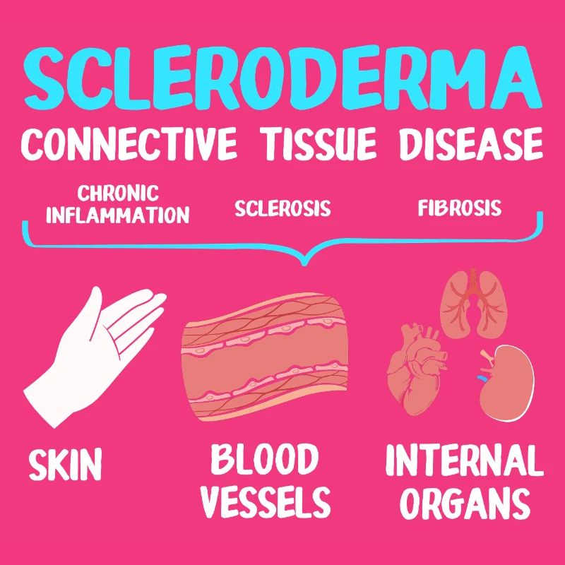 Scleroderma