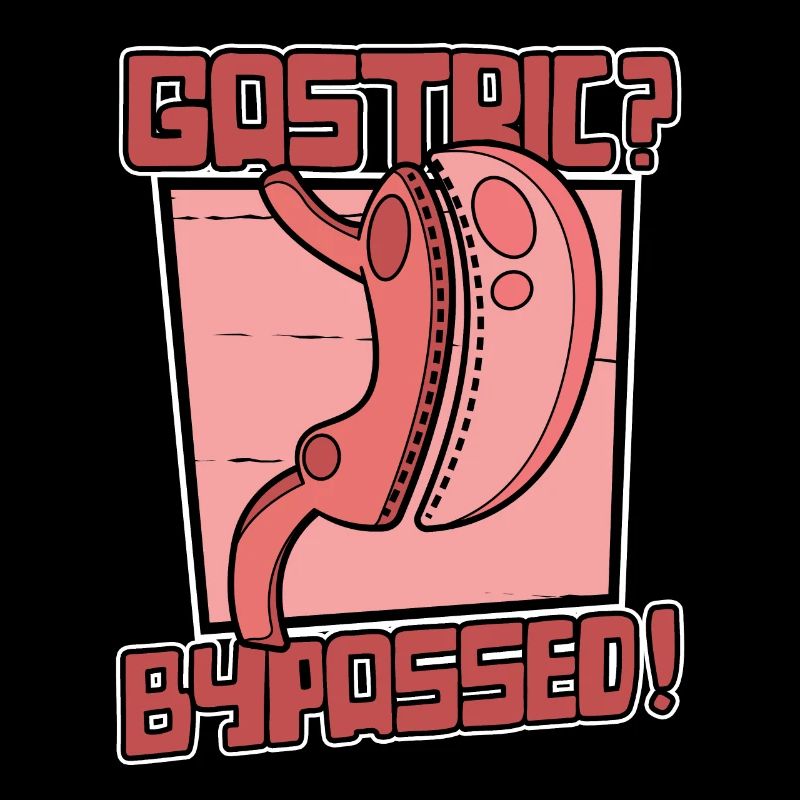Magenbypass Bariatrischer Magenbypass