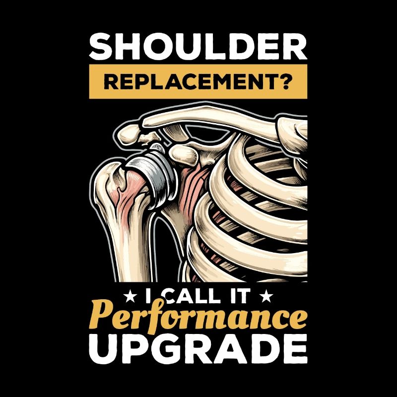 Bionic Shoulder Replacement Surgery Joint Recovery