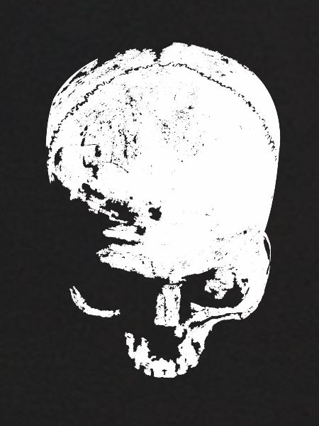 skull