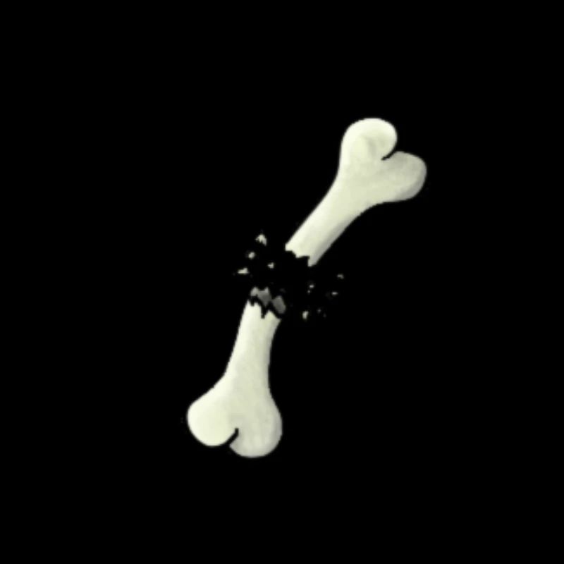 Broken bone
