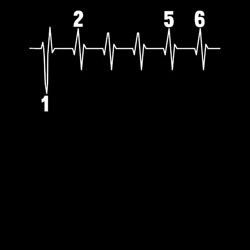 Motorcycle Speed