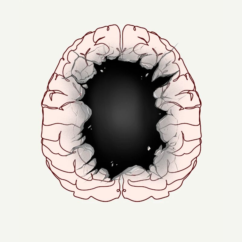 Brain Idiot Idiot Brain Brains Intelligence