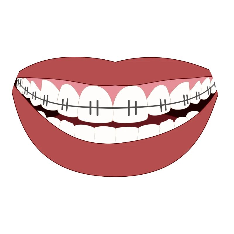 Stahlzähne - Lächeln der Hölle oder Eisen!