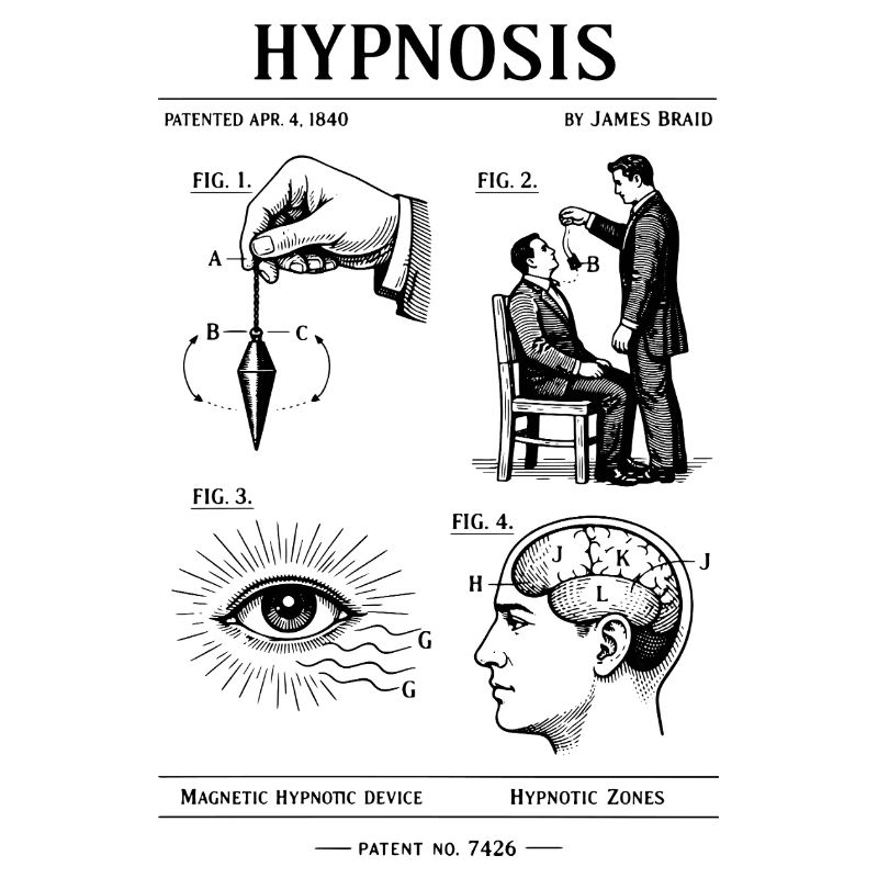 Conception du plan d’hypnose