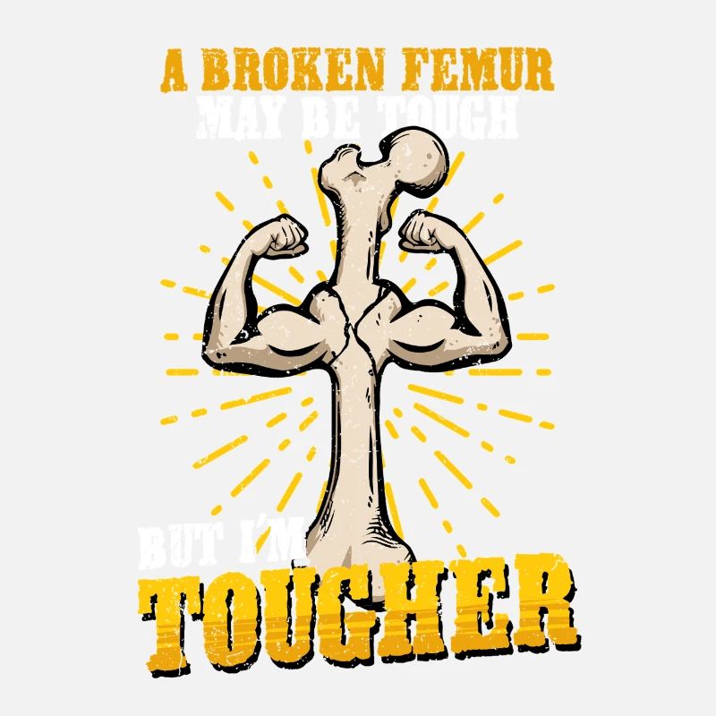 Leg fracture Broken thigh