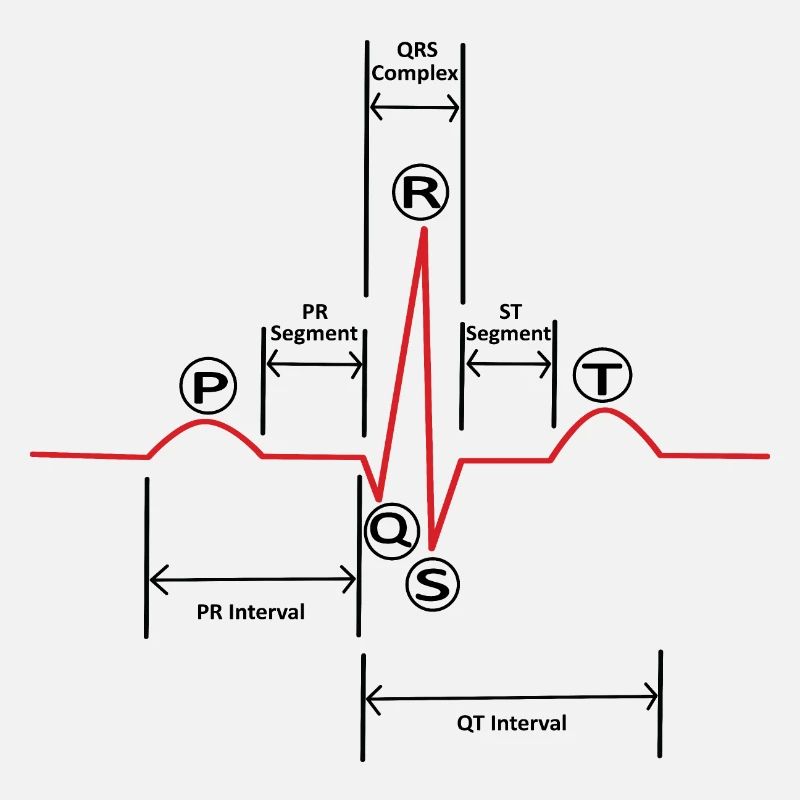 ECG v2