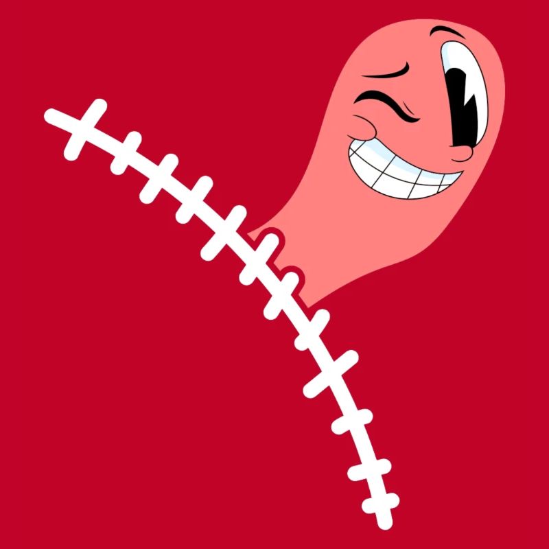 Appendectomy Appendicitis