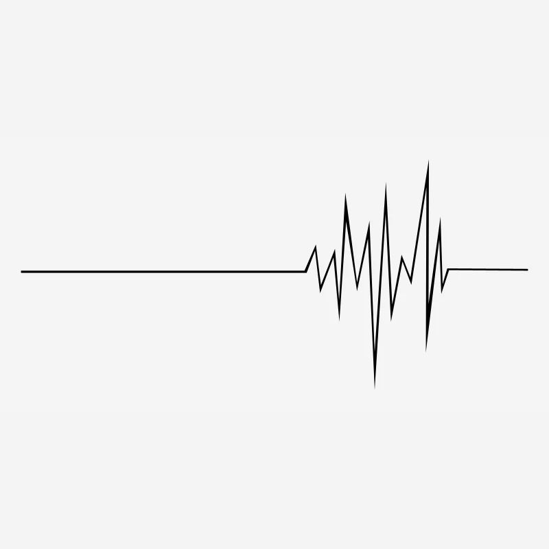 ECG (md)