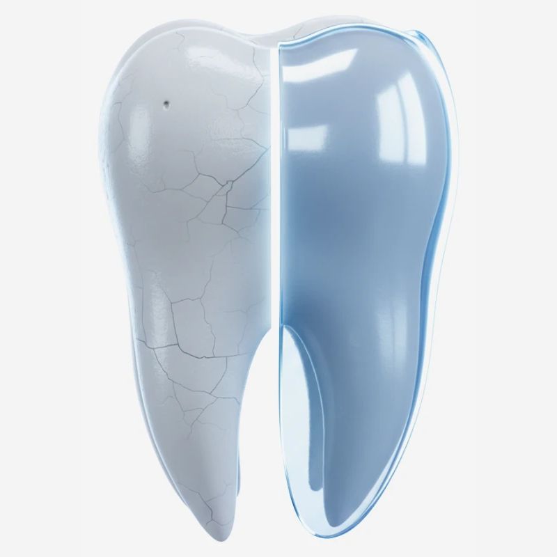 healthy-broken-tooth-before-after-3d