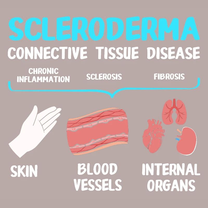 Scleroderma