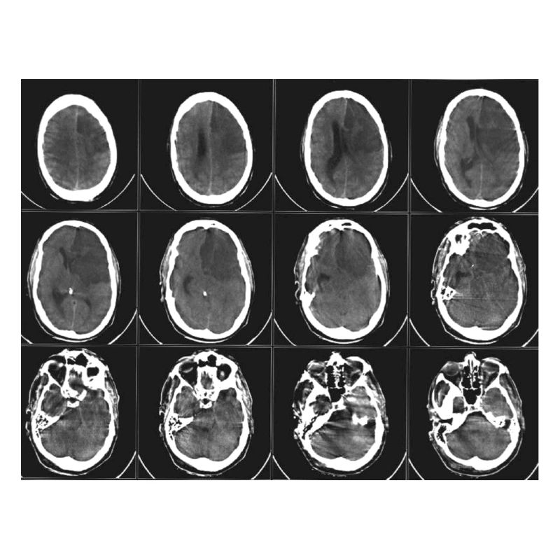 Brain, brain