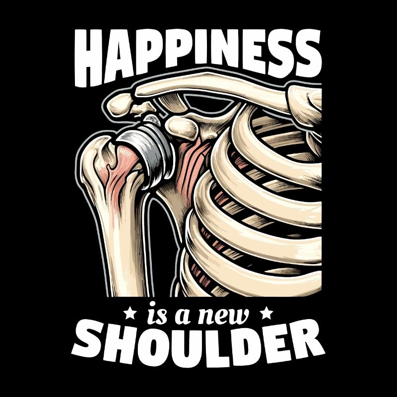 Bionic Shoulder Replacement Surgery Joint Recovery