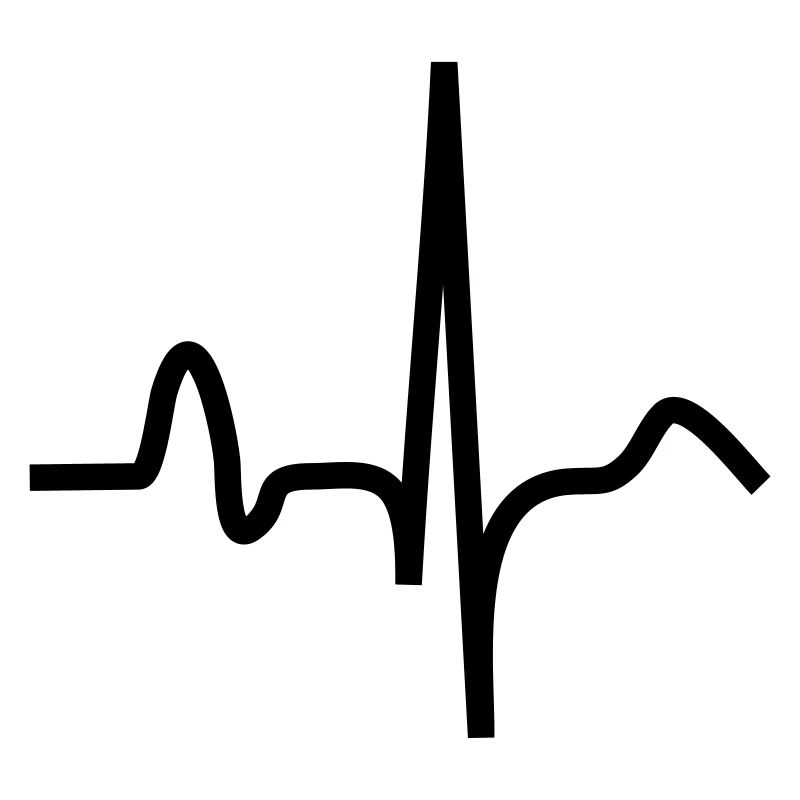 EKG