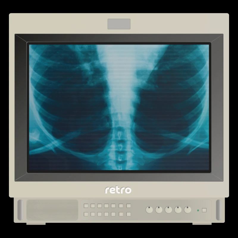 PVM Lover - X-ray