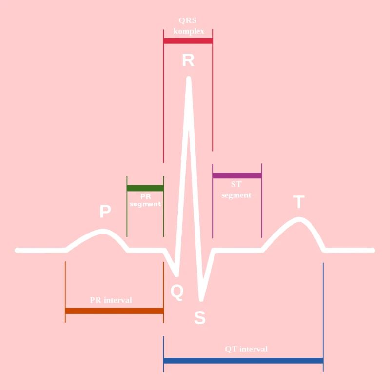 ekg herzschlag
