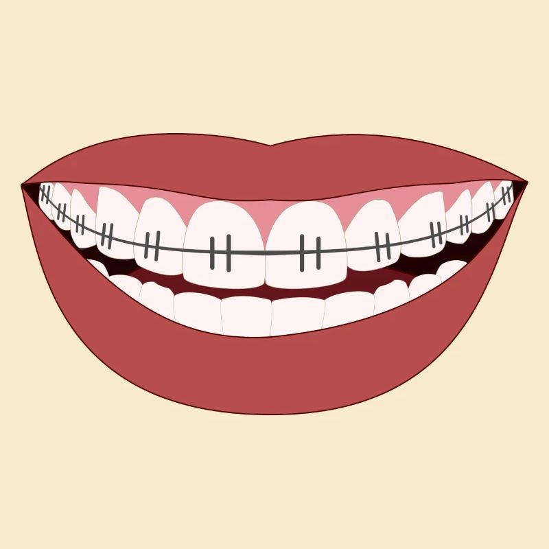 Stahlzähne - Lächeln der Hölle oder Eisen!