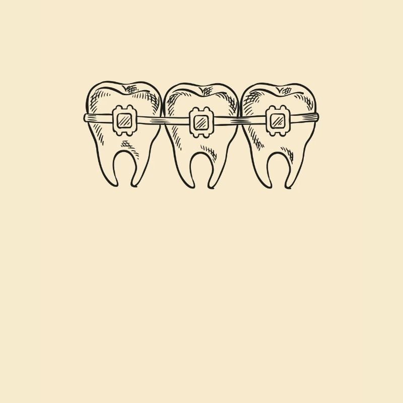 Brackets Feste Spange
