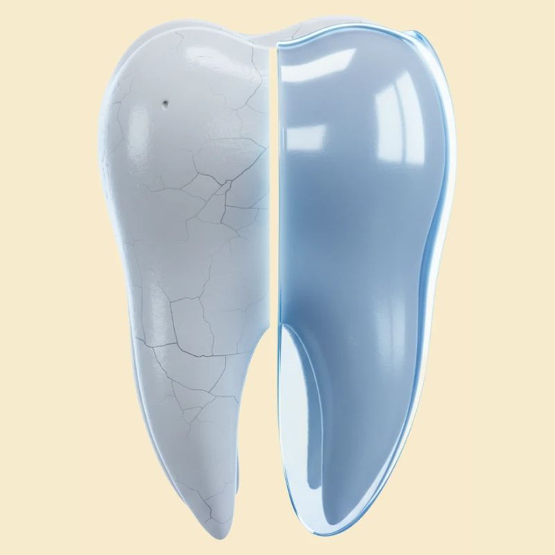 gesunder-kaputter-zahn-vorher-nachher-3d