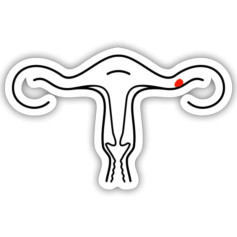 Schematic uterus (2c)