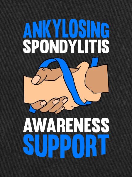 Ankylosing spondylitis, ankylosing spondylitis