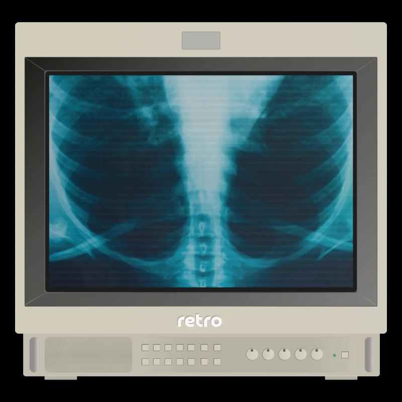 PVM Lover - X-ray