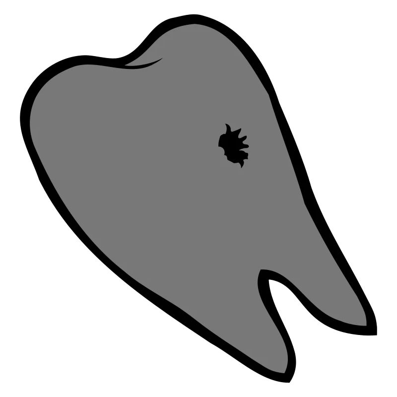 Caries hole tooth