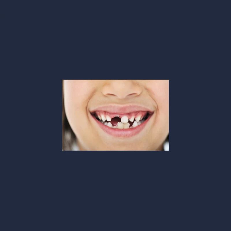 Dents de lait