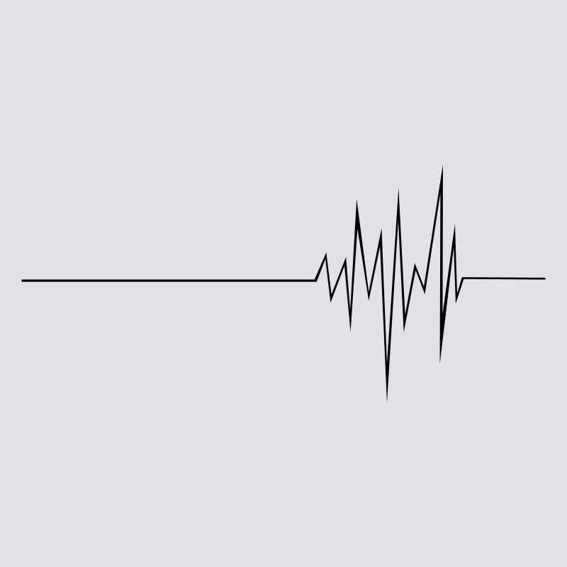 ECG (md)