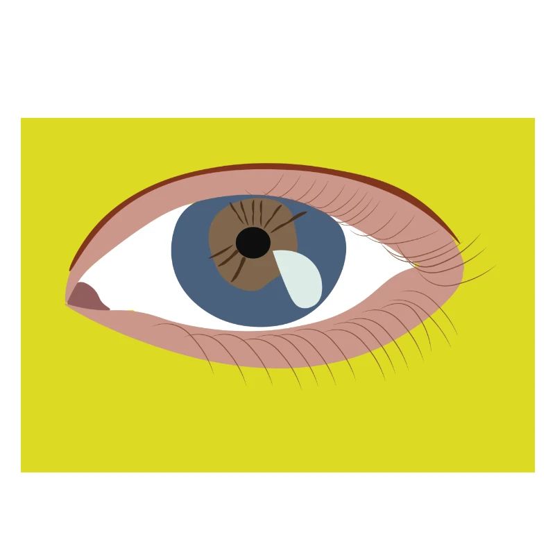 Oeil