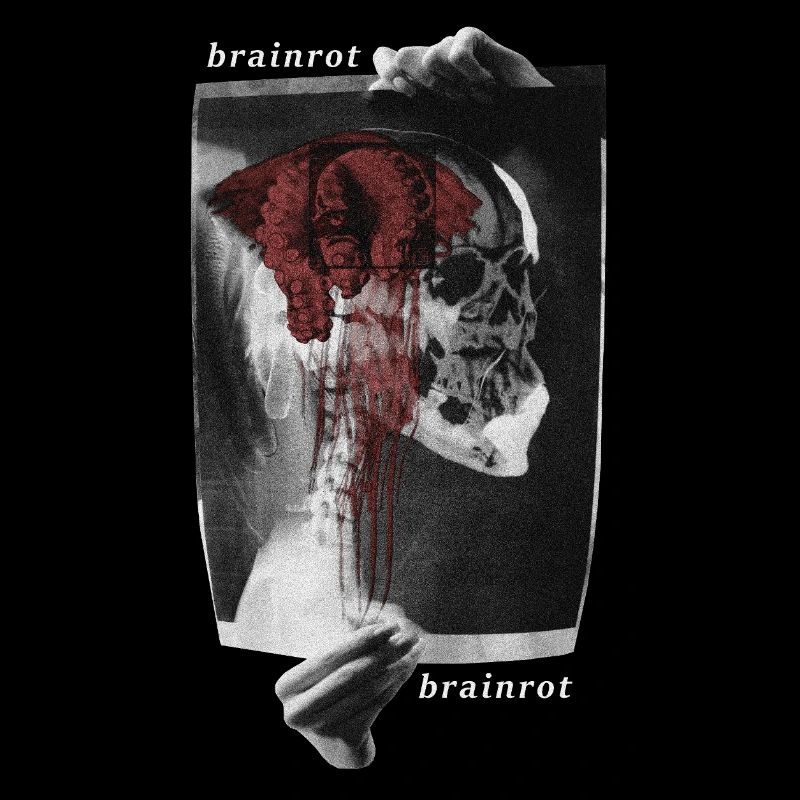 Brainrot