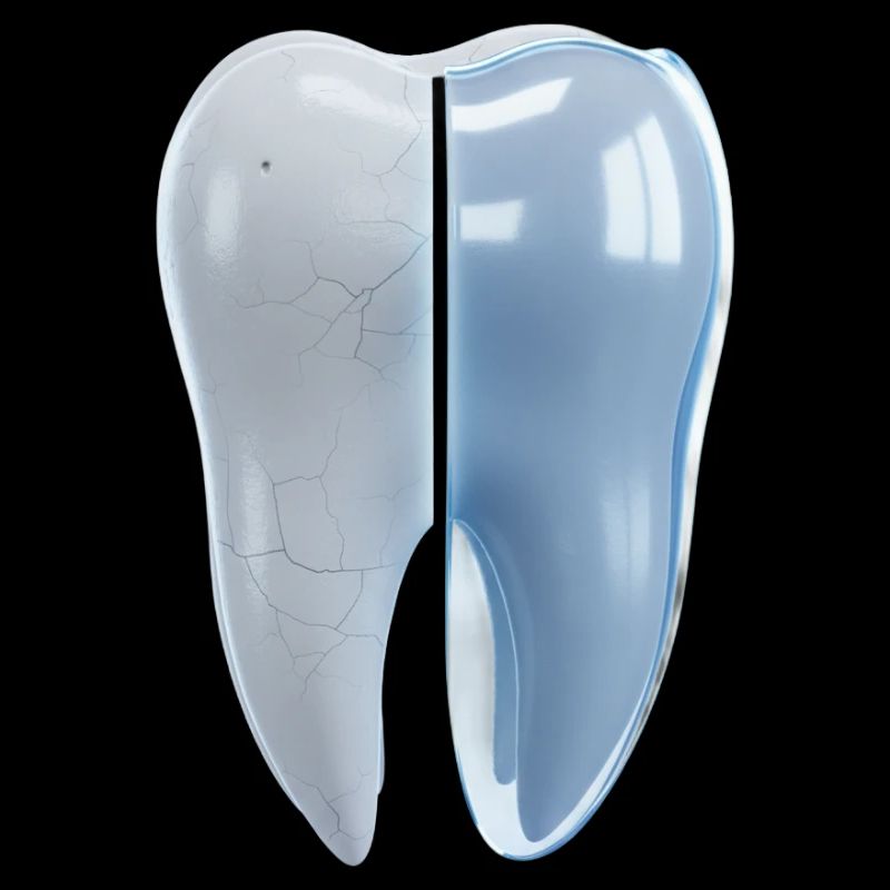 gesunder-kaputter-zahn-vorher-nachher-3d
