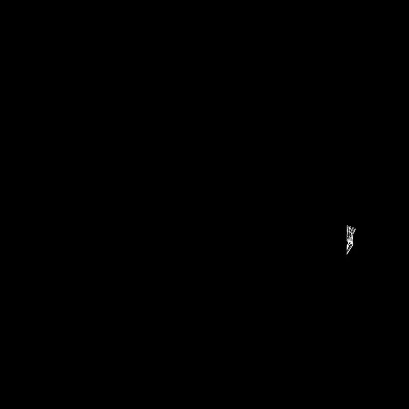 Dancing skeletons