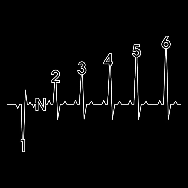 Six pics d’art de impulsions ECG