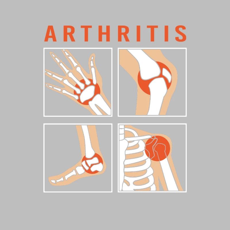 Arthritis Rheuma