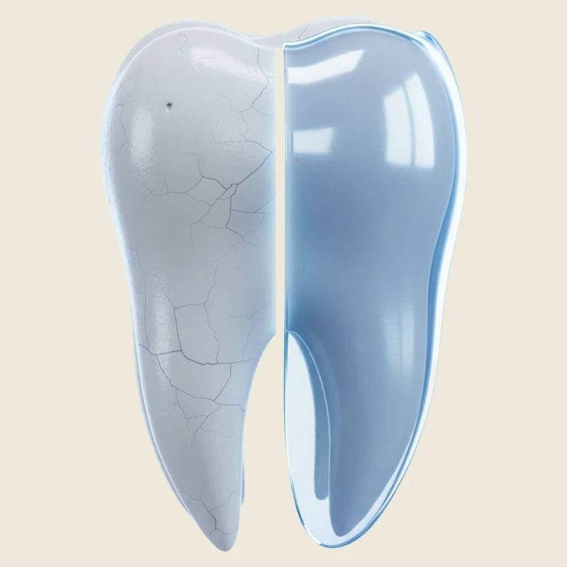 gesunder-kaputter-zahn-vorher-nachher-3d