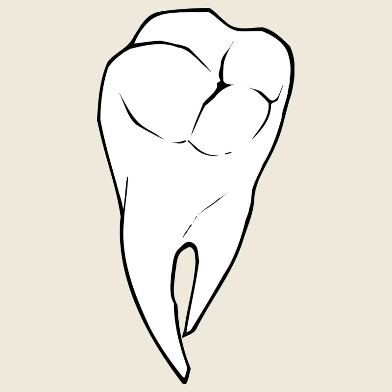 dent
