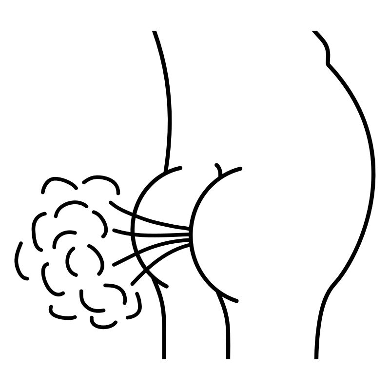 Fart