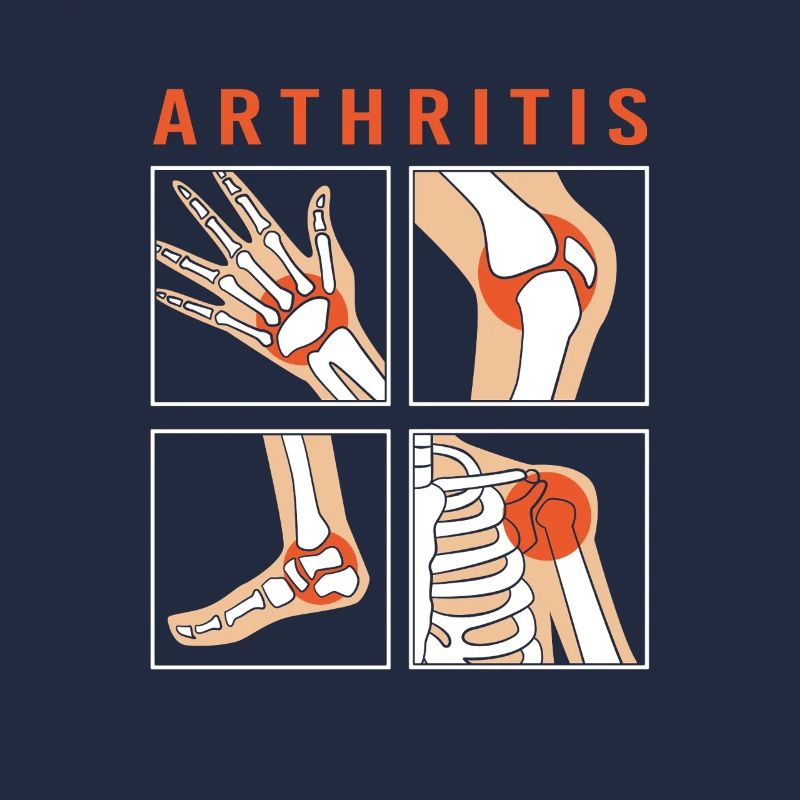 Arthritis Rheuma
